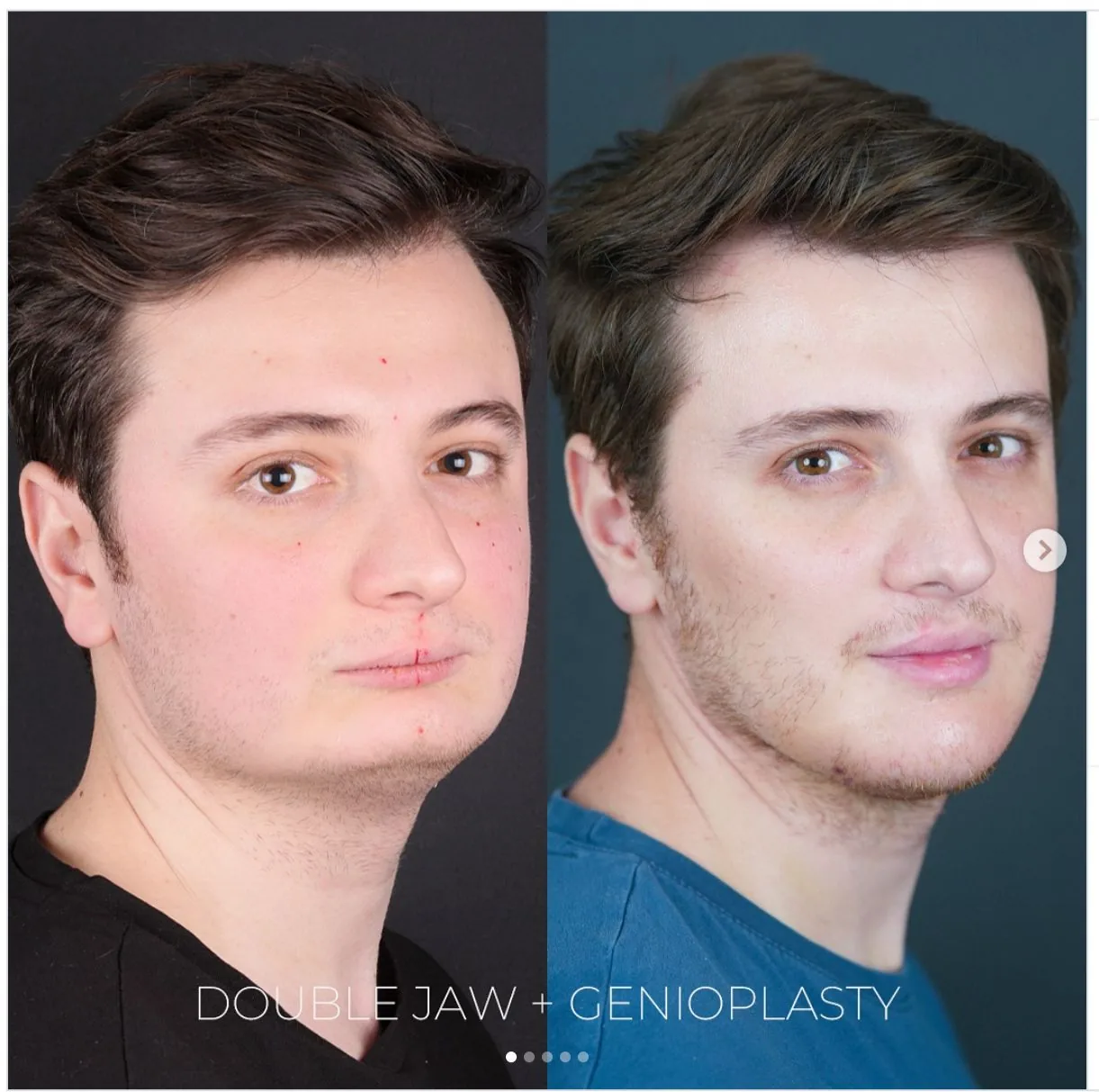 Dr. Mehmet Cömert Instagram