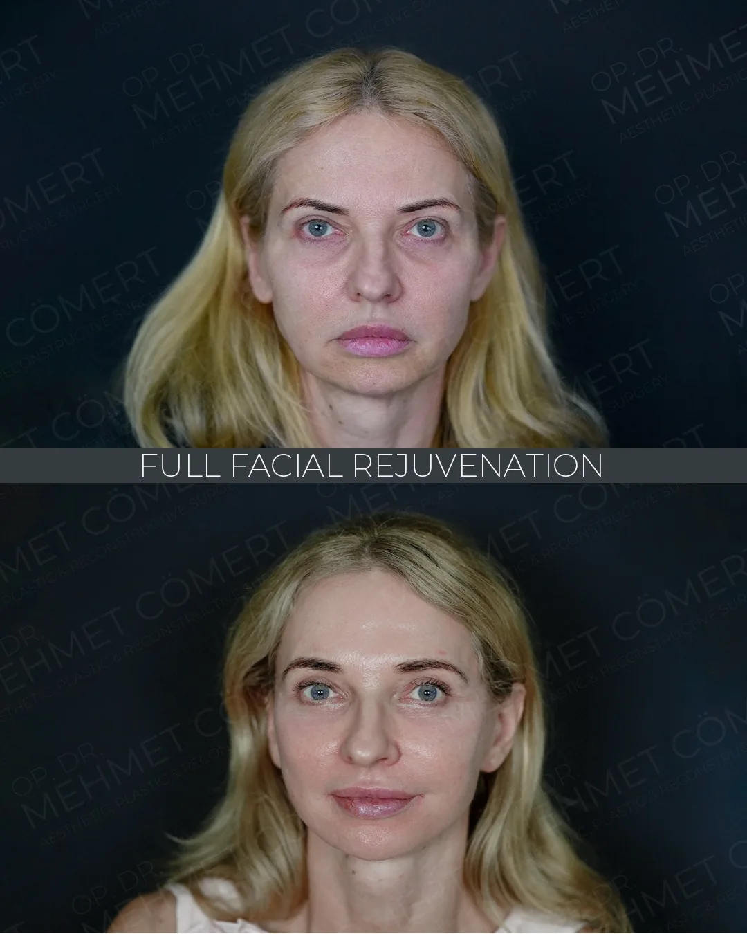 Dr. Mehmet Cömert Instagram