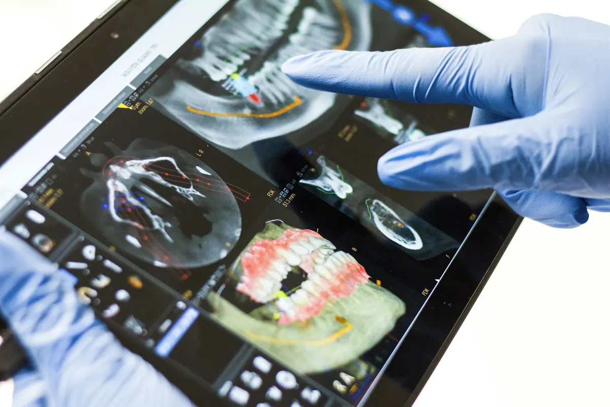 Gloved hand pointing at 3D scan images of the jaws on a tablet