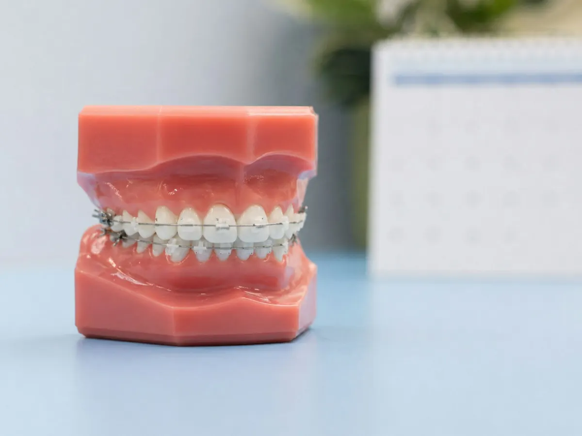 Dental model of a bite with orthodontic braces