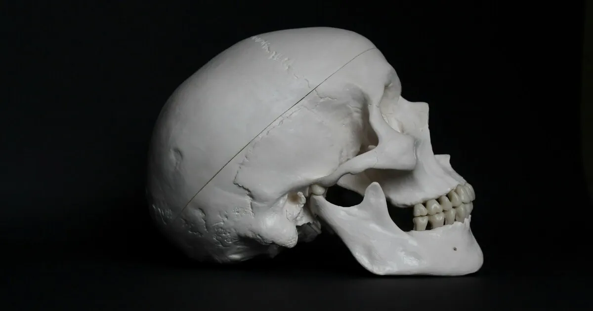 Side view of a human skull model on a black background, showing the upper and lower jaw